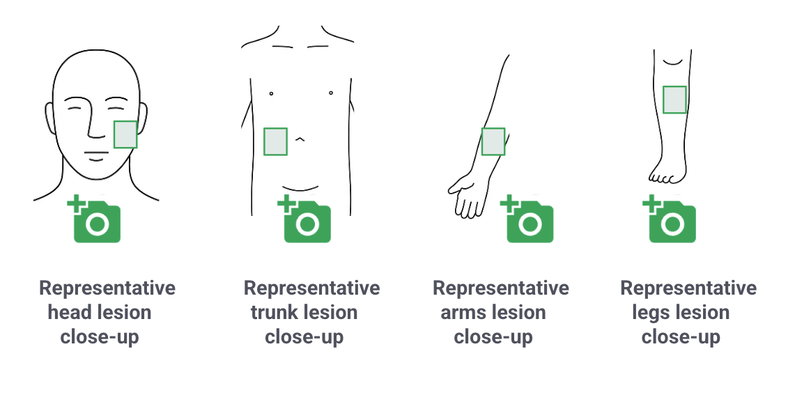 Representative body area lesion close ups