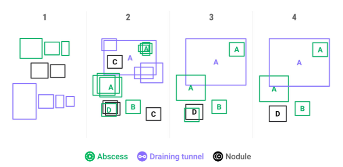 data splitting