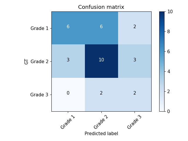 Confussion matrix between the model predictions and the GT