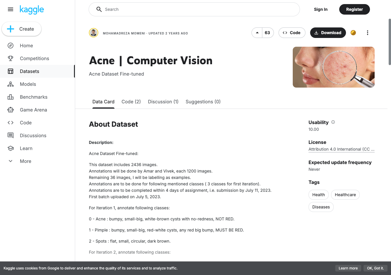 Kaggle acne dataset page showing CC-BY-4.0 license