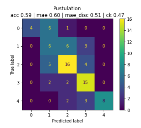 pustules performance